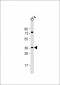Zebrafish hey2 Antibody (C-term)
